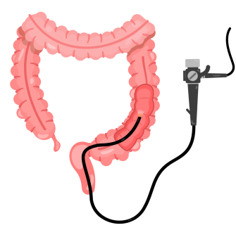 کولونوسکوپی